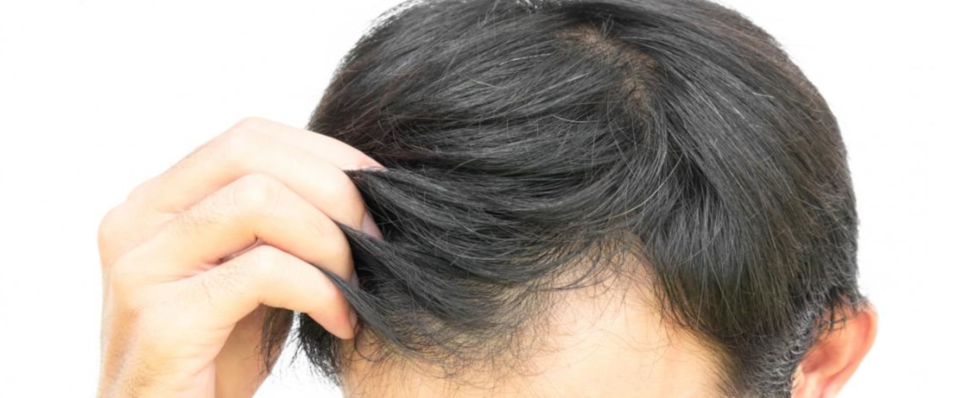 The Key Ingredients of f5x that Strengthen Hair Follicles