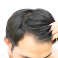 The Key Ingredients of f5x that Strengthen Hair Follicles